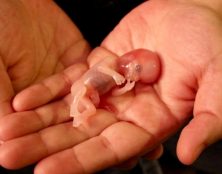IVG, IMG, avortement jusqu’au terme de la grossesse