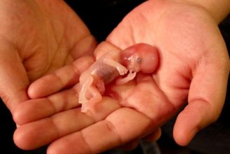 L’avortueur stockait 2246 foetus d’êtres humains