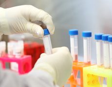 Un partenariat stratégique pour la recherche sur la trisomie 21 et la maladie d’Alzheimer