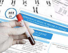 Dépistage prénatal et manipulations génétiques dans la loi de bioéthique : la fondation Lejeune attentive