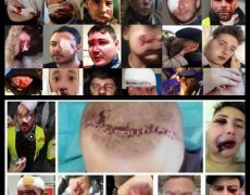 Violences policières : cela commence à sortir
