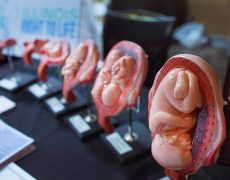 Irlande : 95% des médecins refusent de commettre des avortements