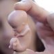 Irlande du Nord : les avortements en hausse de 23,53 %
