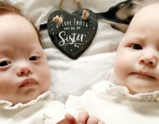 Des parents accueillent avec joie des jumeaux dont l’un est atteint de trisomie