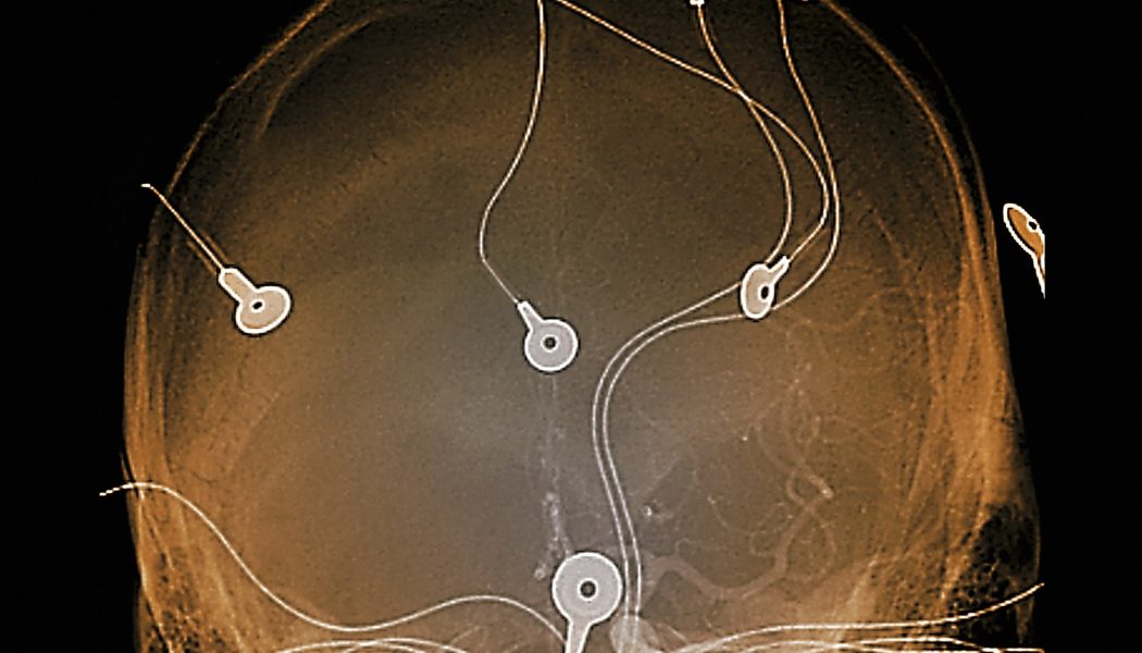 15 % des patients "non conscients" ou "en état végétatif" seraient en réalité CONSCIENTS ! 26brain-superjumbo-1050x600