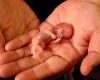 Alliance VITA appelle à regarder en face la réalité de l’avortement