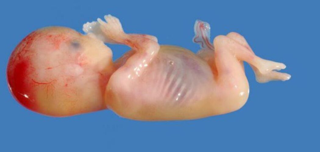 Voici un foetus de 14 semaines