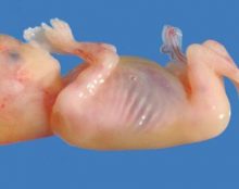 Voici un foetus de 14 semaines