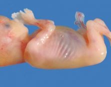 Voici un foetus de 14 semaines