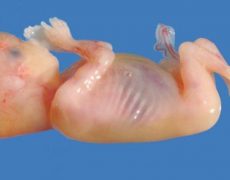 Voici un foetus de 14 semaines
