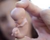 Plainte contre le Planning familial pour « trafic de mineures»