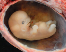 Action : Allongement du délai de l’avortement en seconde lecture à l’assemblée nationale