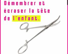 Il y a un vrai combat à mener pour les femmes, particulièrement pour les femmes en difficulté que le gouvernement envoie dans un bloc pour se faire charcuter
