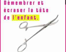 Il y a un vrai combat à mener pour les femmes, particulièrement pour les femmes en difficulté que le gouvernement envoie dans un bloc pour se faire charcuter