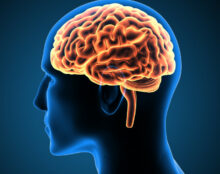 Un implant cérébral sur des humains