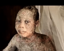 Ouganda : Refusant de renier Jésus, une famille reçoit des coups de bâtons et des jets d’acide