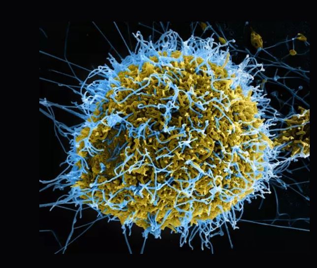 En 2016, un laboratoire canadien avait recréé en six mois la variole du cheval