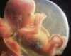 Au moment où le Parlement vote l’avortement dans la Constitution, un juge considère que l’enfant à naître était viable dans l’affaire Palmade