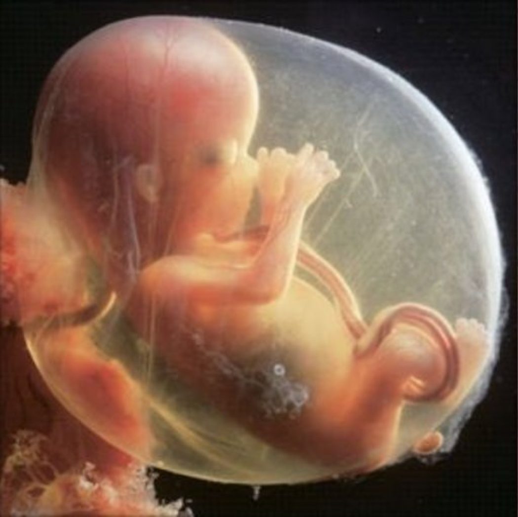 l'affaire Palmade et l'imbroglio juridique concernant le foetus Gh1h63hxwaaylfo-1050x1048