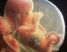 Témoignages suite aux décès d’enfants in utero ou à la naissance