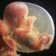 Au moment où le Parlement vote l’avortement dans la Constitution, un juge considère que l’enfant à naître était viable dans l’affaire Palmade