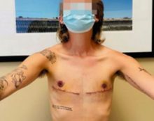 La “médecine” Frankenstein, la barbarie du gender