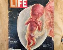 Les images mondialement connues du photographe suédois Lennart Nilsson concernent des embryons conservés après des avortements