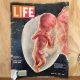 Les images mondialement connues du photographe suédois Lennart Nilsson concernent des embryons conservés après des avortements