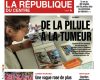 Méningiome causé par certaines pilules