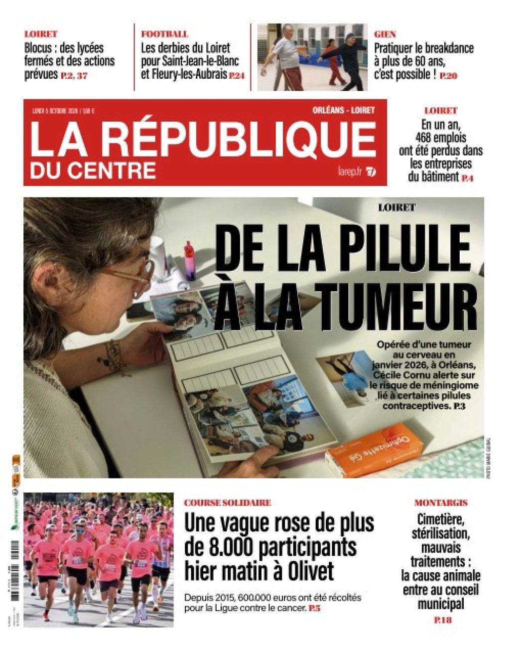 Méningiome causé par certaines pilules