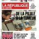 Méningiome causé par certaines pilules